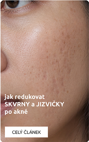 Skvrny a jizvičky
